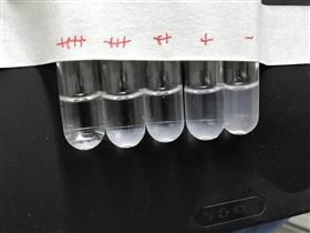 试管凝集法 试管凝集法