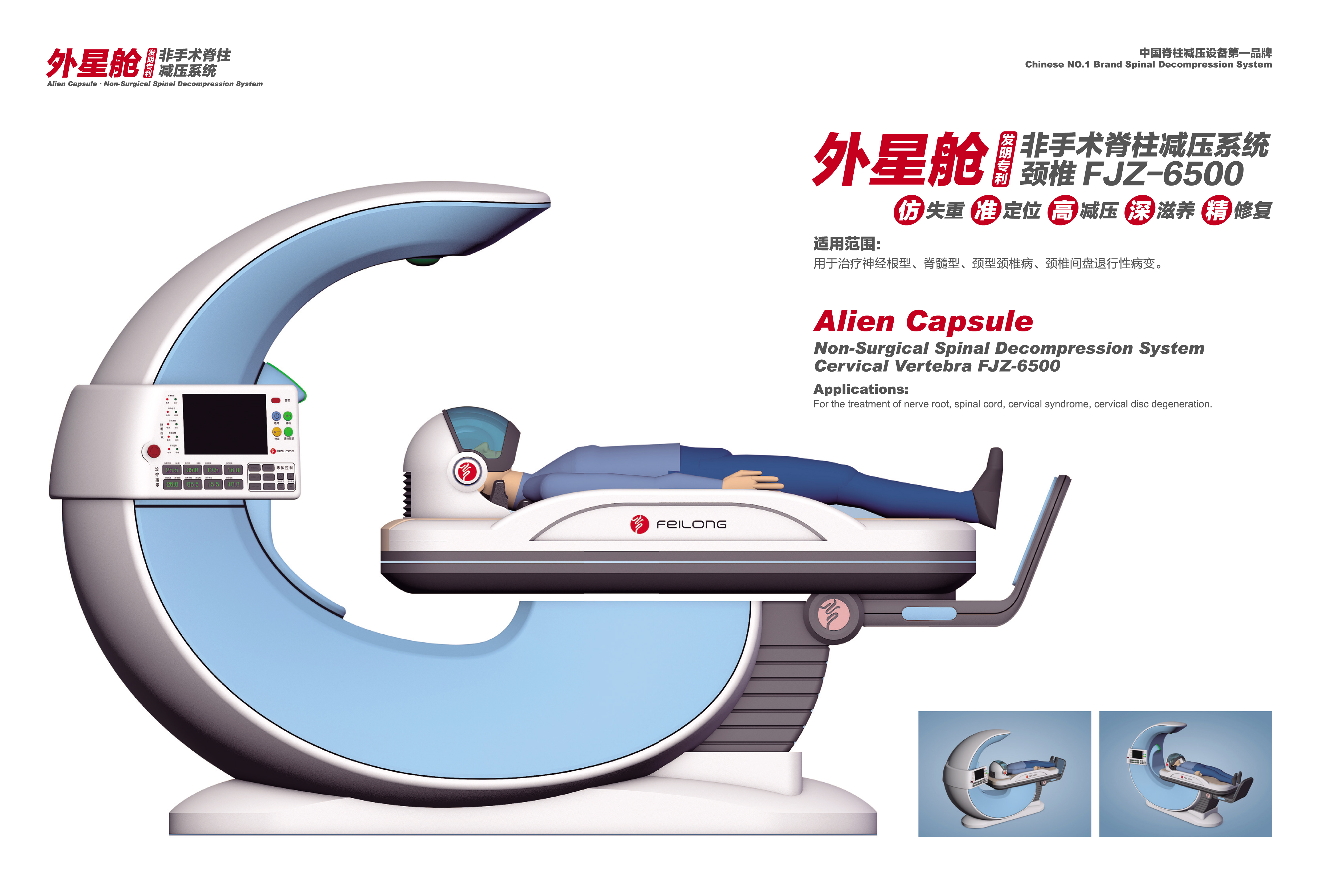 非手术脊柱减压系统腰椎