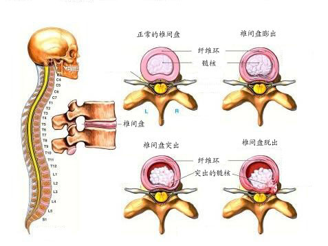椎间盘解剖图